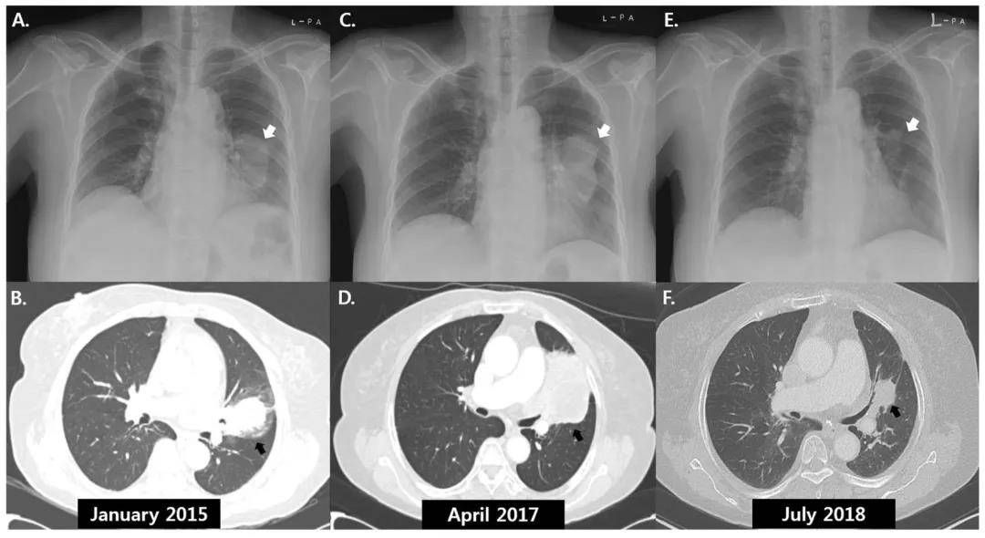 1638258846808955.jpg 无奇不有!盘点那些神奇的癌症自愈现象
